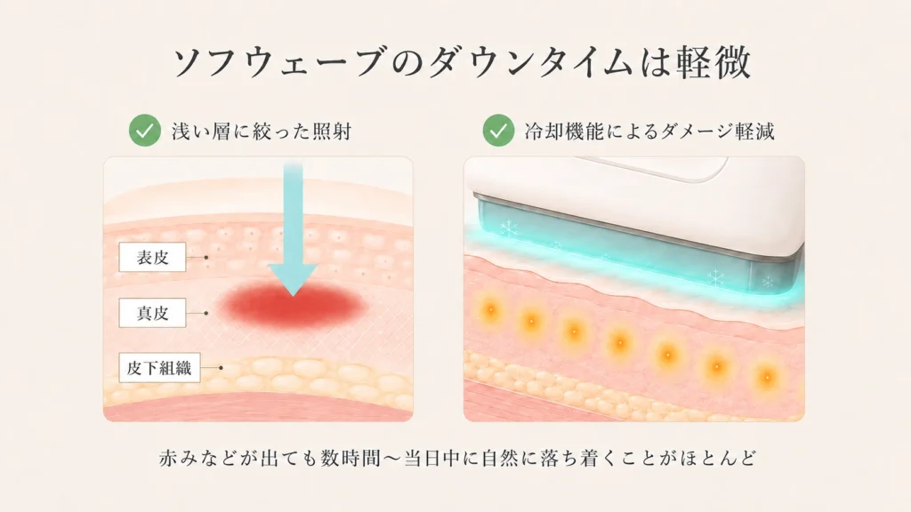 ソフウェーブのダウンタイムは軽微