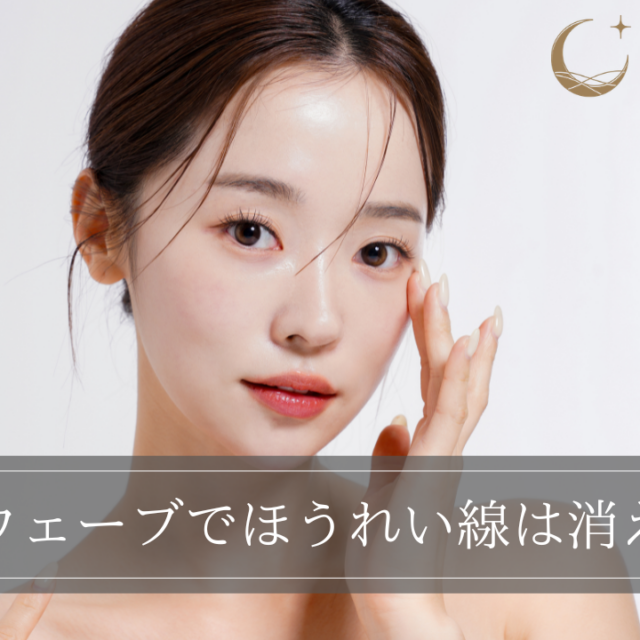 ソフウェーブでほうれい線は消える？メカニズムや症例を紹介
