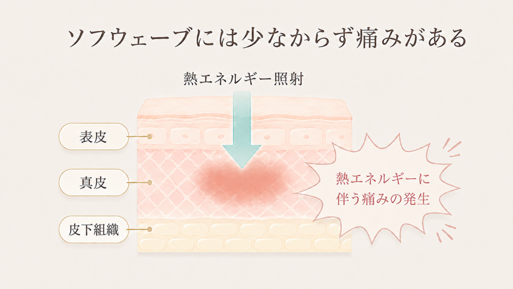 ソフウェーブには少なからず痛みがある