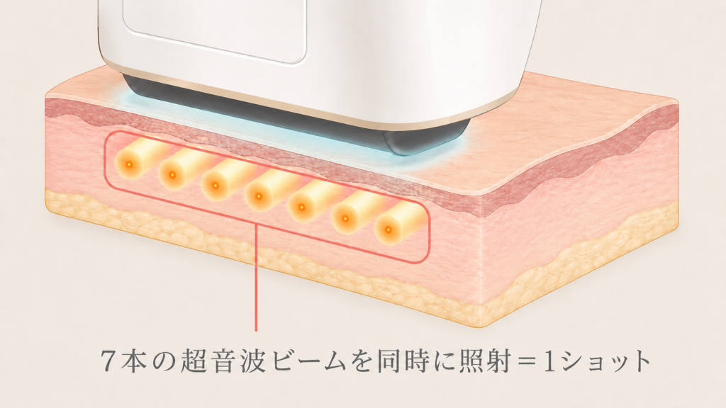 ソフウェーブのショット数とは