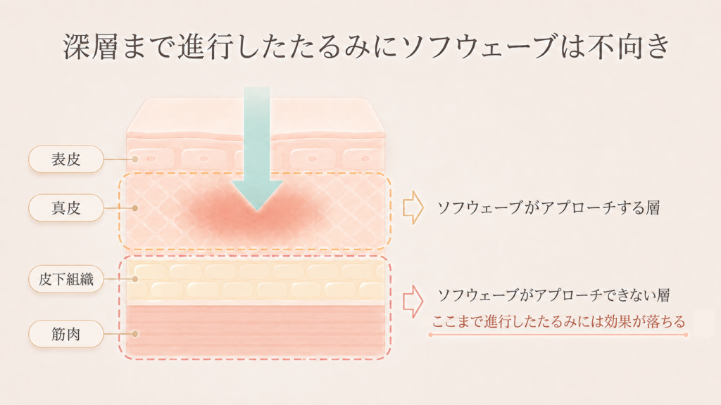 深層まで進行したたるみにソフウェーブは不向き